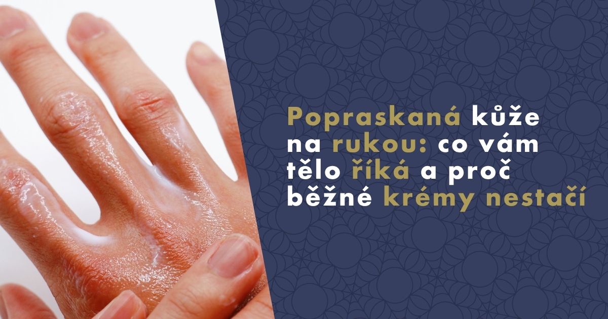 popraskana-kuze-na-rukou (1)